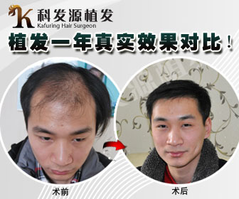 科發(fā)源植發(fā)長(zhǎng)沙分院即將盛大開(kāi)業(yè)