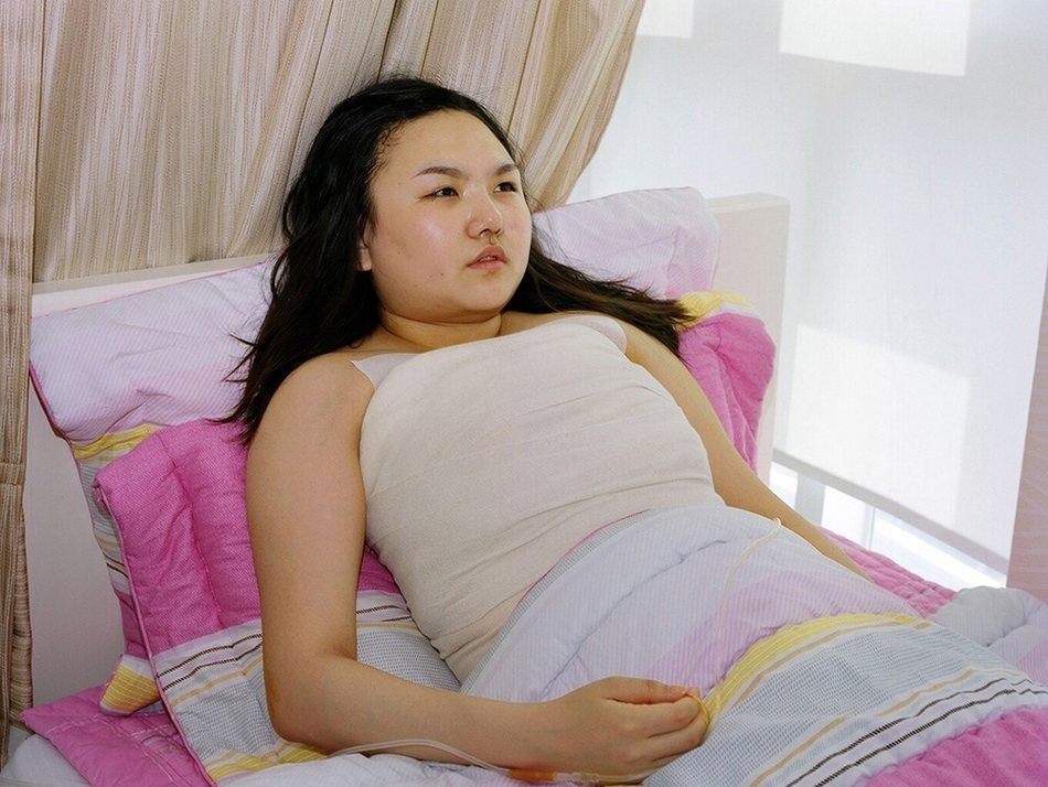 韓國(guó)女子整容術(shù)后的生活（組圖）